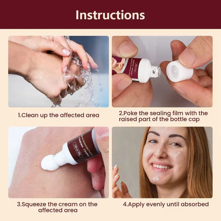 Sumifun Rosacea Relief Cream